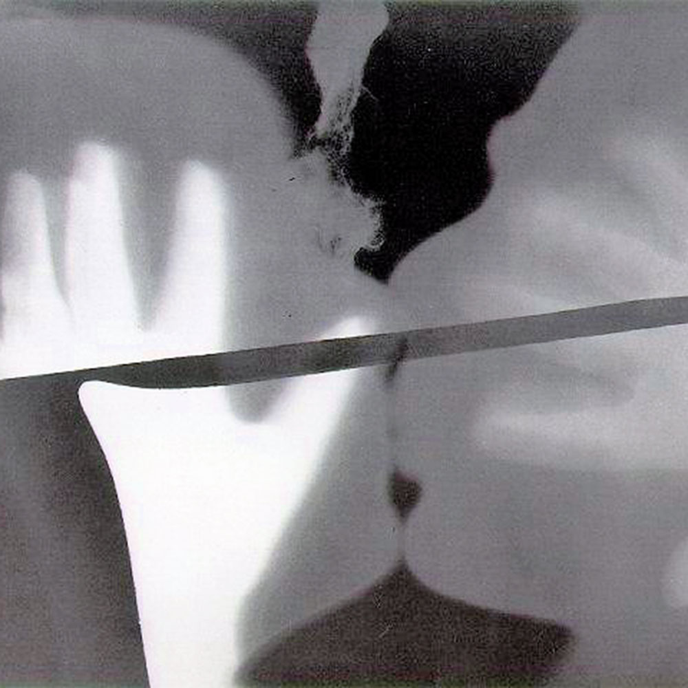 Man Ray, the Kiss, 1922