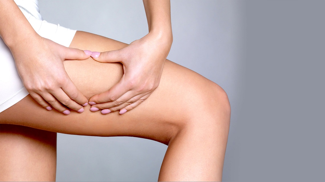 rimedi naturali per cellulite